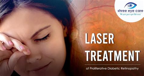 Laser Treatment Of Proliferative Diabetic Retinopathy Best Eye Care