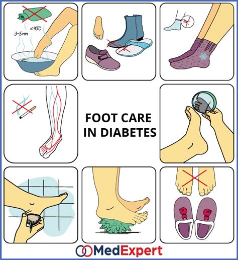 Diabetic Foot Syndrome Treatment Diagnostics Services And Symptoms