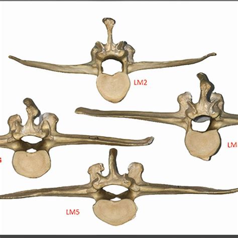 Deer Vertebral Epiphysis On Tear Drop Hoops Br