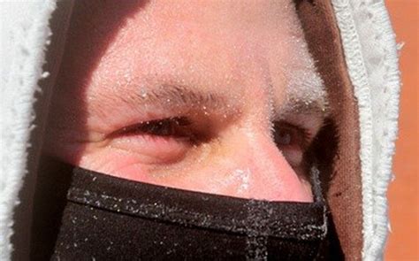 Warning Signs Of Frostbite Can Begin At 32 Degrees
