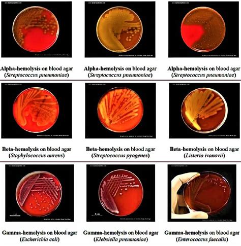 Blood Agar Definition Preparation Composition Application And