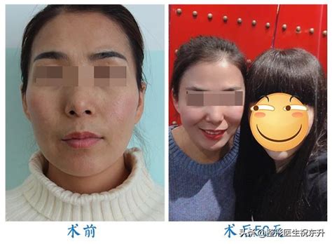 在 mac 上，從「蘋果」選單選擇「關於這台 mac」。 在 iphone、ipad、ipod touch、ipod 或 apple watch 中，選擇「設定」>「一般」>「關於本機」。 為什麼蘋果肌填充後看起來不自然呢？ - 每日頭條