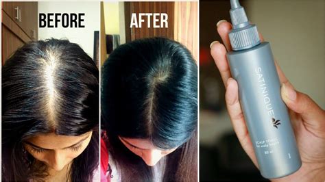 How To Increase Volume And Density Of Hair Amways Satnique Scalp