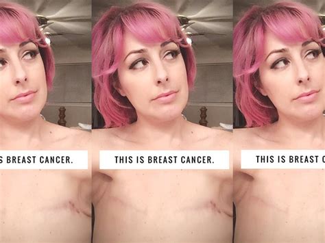 This Breast Cancer Survivor Shared A Topless Selfie To Show Another
