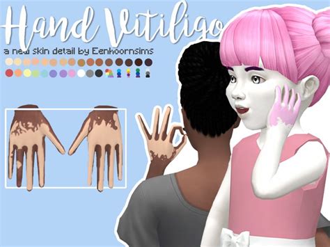 Hand Vitiligo Con Imágenes Sims Sims 4 Ropa