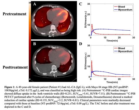 Risk Stratification And Therapy Response Values Of 11c Pib Positron