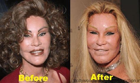 11 Actresses Who Look Horrible After Plastic Surgery