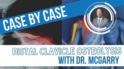What Is Distal Clavicle Osteolysis Youtube
