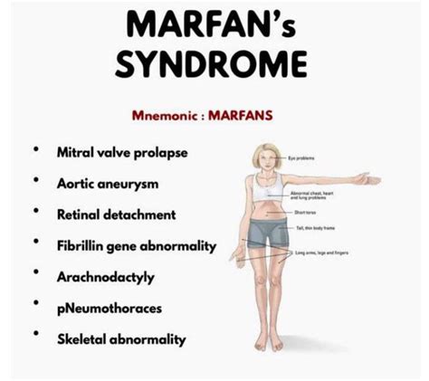 Marfan Syndrome Medizzy
