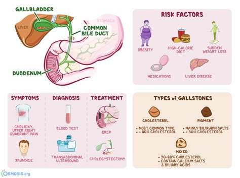 What Are Common Gallbladder Problems Symptoms Causes Diagnosis