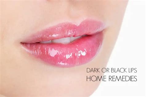 20 Best Diy Natural Home Remedies For Dark Lips Wellnessguide