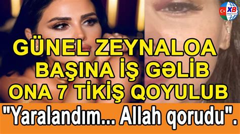 Son DƏqİqƏ GÜnÜl Zeynalova Yaralanib Onun QaŞina 7 TİkİŞ Qoyulub Youtube