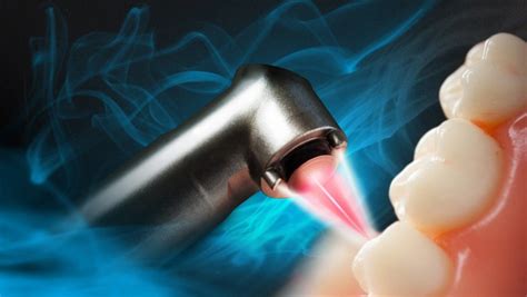 Are Laser Dental Procedures Better Than Traditional Treatments Rely