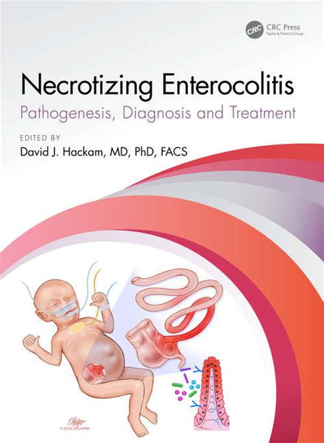 Necrotizing Enterocolitis Uk Education Collection