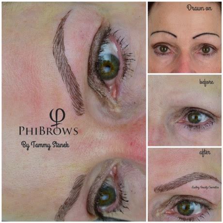 Eyebrow hair loss, the medical name for which is eyebrow hypotrichosis, or eyebrow madarosis, can cause a person to notice thinning hair or missing patches of hair in their eyebrows. Alopecia by Permanent Makeup