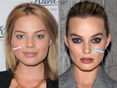 Margot Robbie Botox And Nose Job Did She Get Surgery