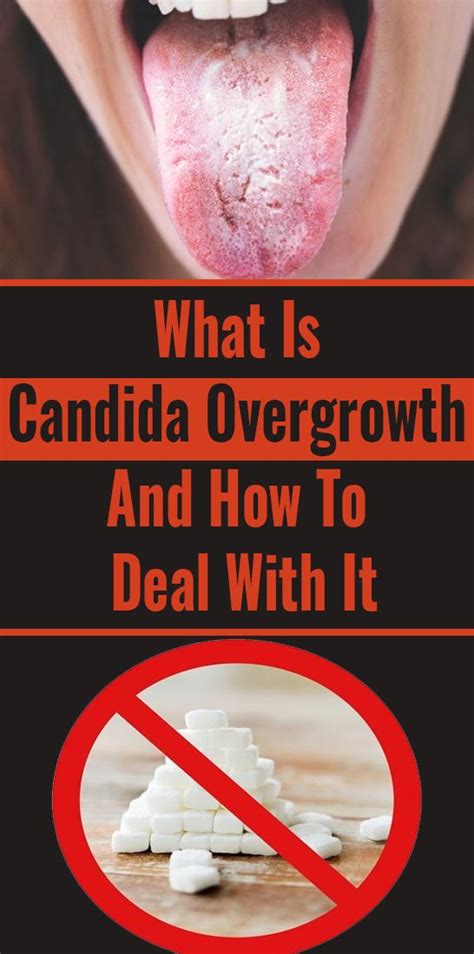 What Is Candida Overgrowth And How To Deal With It Health Lifestyle