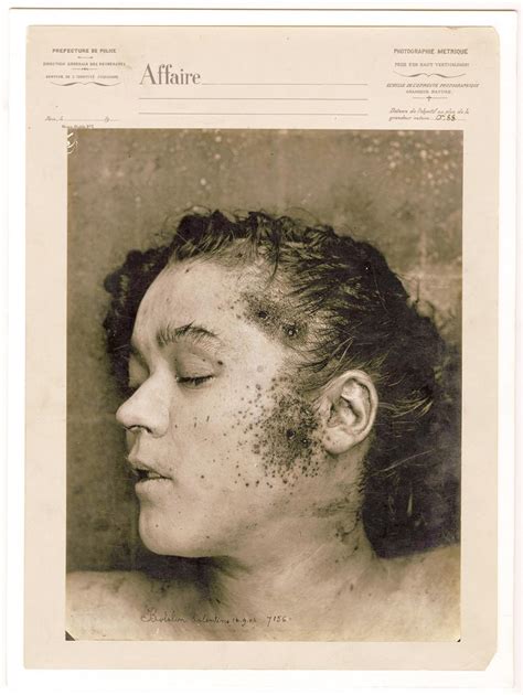 Acid Passion And Dried Blood Photos From Murder Scenes In 1880s Paris