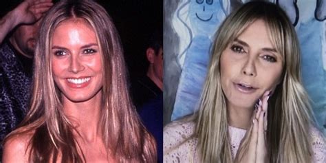 Did Heidi Klum Have Plastic Surgery Nose And Face Before