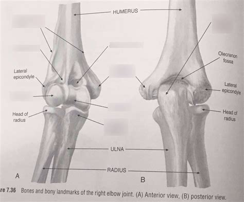 Chapter 79 Bones And Bony Landmarks Of The Elbow Complex P 289