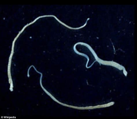 Shock As Doctors Discover Cancer Can Spread From Tapeworms Man Dies After Diseased Cells From