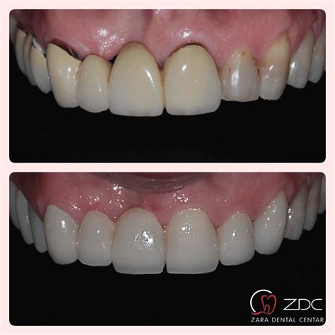 Zara Dental Centar Zadar Dentist Dental Clinic Zadar Implantology