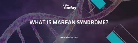 What Is Marfan Syndrome And Why Does It Happen