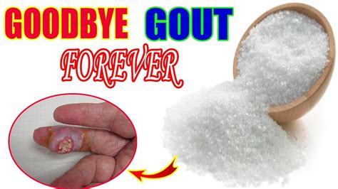 The Best Food For Gout Naturaly Remove Gout Easily With Epsom Salt