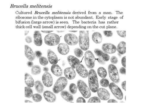 Brucellosis ~ Sekedar Sharing