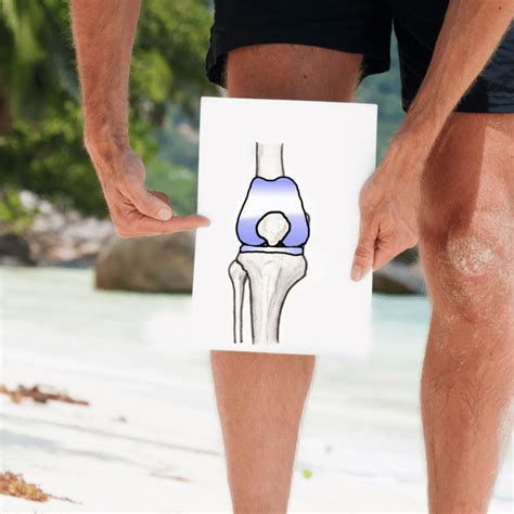 Important Exercises To Do Before A Knee Replacement The Senior