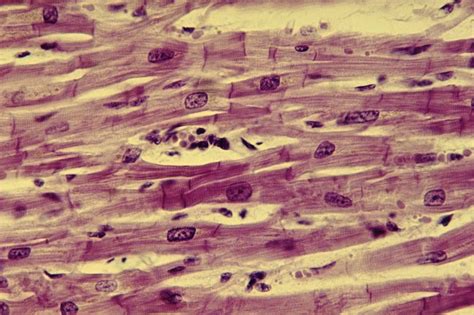 Spinal muscular atrophy (sma) is a rare neuromuscular disorder that results in the loss of motor. Human Physiology - Introduction To The Muscular System | Genius