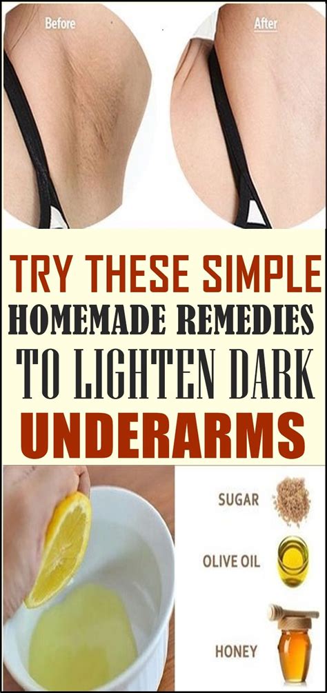 Try These Simple Homemade Remedies To Lighten Dark Underarms Dark
