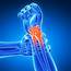 Joint Pain  Facts Types And Prevention Way To Be Healthy