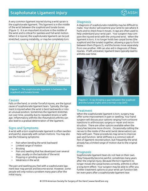 Wrist Condition Scapholunate Ligament Injury — Associated Hand