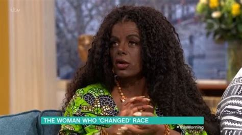 White Woman Who Claims Shes Turned Black Due To Injections Wants To
