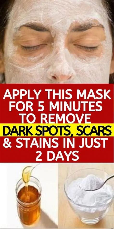 Pin On How To Get Rid Of Brown Spots On Hands