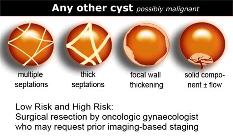 The Radiology Assistant Roadmap To Evaluate Ovarian Cysts