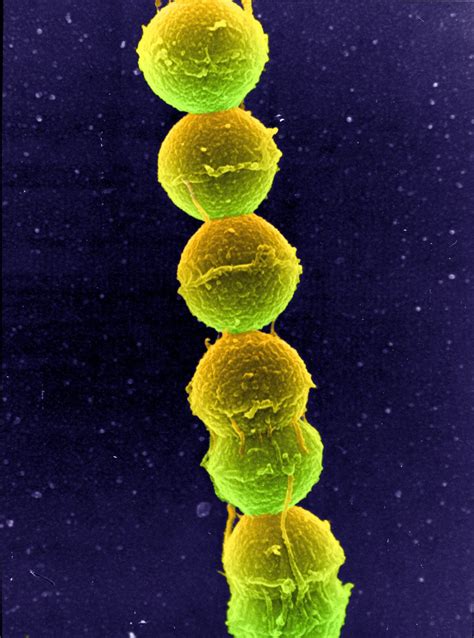 Image Of Streptococcus A Type Genus Of Spherical Bacteria That Can