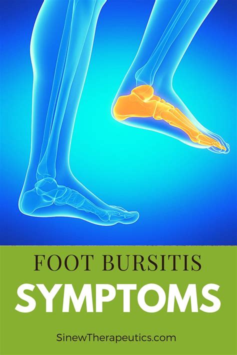 Pin On Foot Bursitis