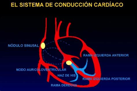 El Sistema De Conducción Cardiaco Niurka Dalia Caceres Callo Udocz