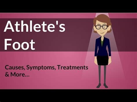 Athletes Foot Tinea Pedis Causes Risk Factors Signs Symptoms
