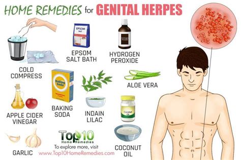 Home Remedies For Genital Herpes Top 10 Home Remedies