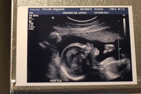 Keeping Up With The Taylors Baby Boy 2 20 Week Ultrasound