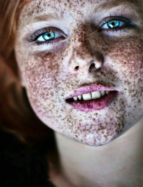 Pin By Daniyal Aizaz On Freckles Beautiful Freckles Black Hair And
