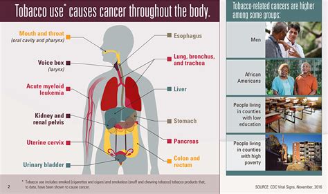 Cancer And Tobacco Use Vital Signs Cdc