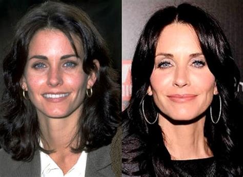 Courteney Cox Plastic Surgery Speculations Have Been Confirmed