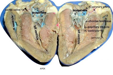 412 Heart Dissection