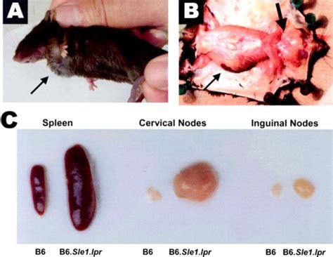 B6sle1lpr Mice Exhibit Prominent Splenomegaly And Lymphadenopathy As