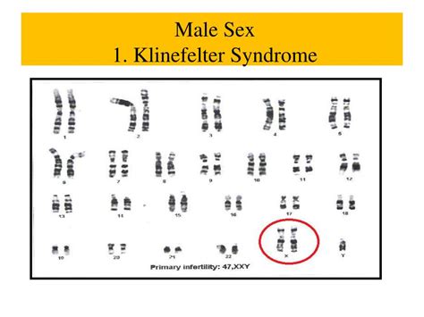 Ppt Chromosomal Abnormalities I Sdk October 13 2012 Powerpoint Presentation Id2408985