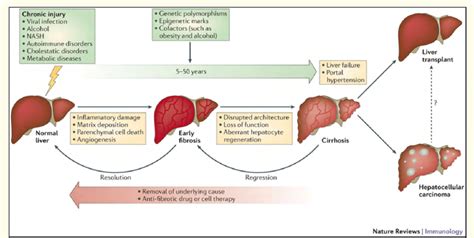 Schematic Representation Of Course Of Chronic Liver Diseases Etiology